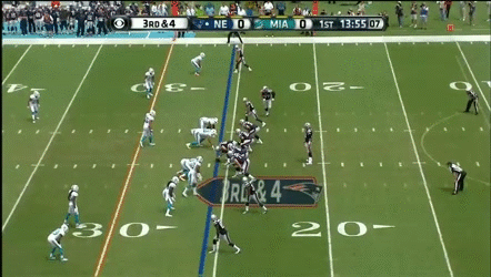 Tom Brady v. Pressure 1