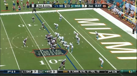 Tom Brady v. Pressure 4