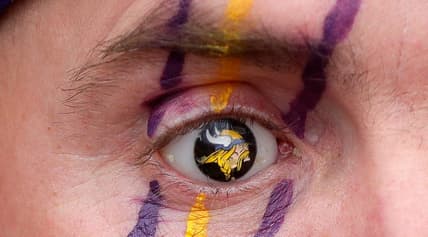 Vikings fan Brian Foss displaying a custom prosthetic eye with team logo at a fan event
