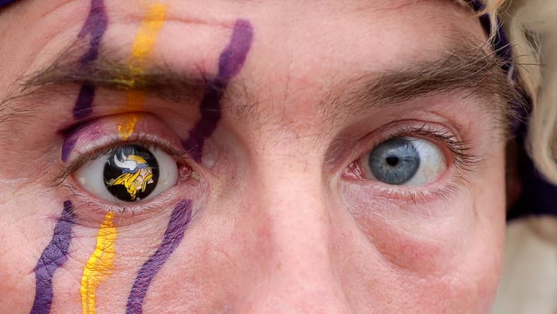 Vikings fan displaying a custom prosthetic eye with team logo at a fan event.